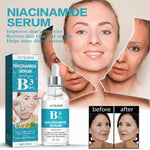 Suero facial de niacinamida, hidratante, antienvejecimiento, 2X1 Q220 envio gratis