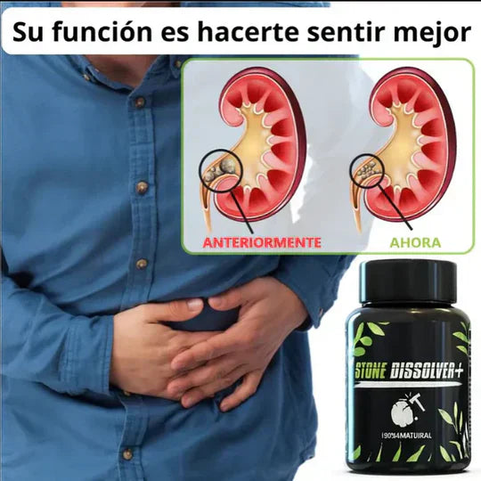 🍃 STONE DISSOLVER™ - Disuelve Cálculos, Alivia Dolor y Mejora el Flujo Urinario | Envió gratis 🚚
