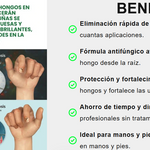 🌱JoyPretty™ el cuidado intensivo de uñas- Q160+ envio gratis  (manos y pies)