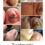 🌱JoyPretty™ el cuidado intensivo de uñas- Q160+ envio gratis  (manos y pies)