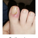 🌱JoyPretty™ el cuidado intensivo de uñas- Q160+ envio gratis  (manos y pies)