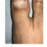 🌱JoyPretty™ el cuidado intensivo de uñas- Q160+ envio gratis  (manos y pies)