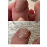 🌱JoyPretty™ el cuidado intensivo de uñas- Q160+ envio gratis  (manos y pies)