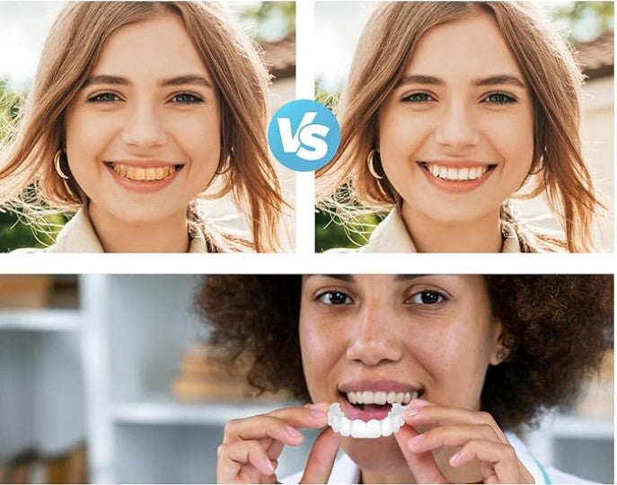 CARILLAS DENTALES 2X1 Snap-On Smile ENVIO GRATIS