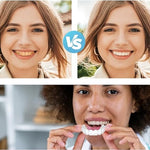 CARILLAS DENTALES 2X1 Snap-On Smile ENVIO GRATIS