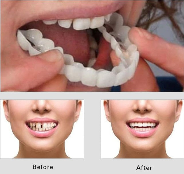 CARILLAS DENTALES 2X1 Snap-On Smile ENVIO GRATIS