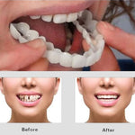CARILLAS DENTALES 2X1 Snap-On Smile ENVIO GRATIS