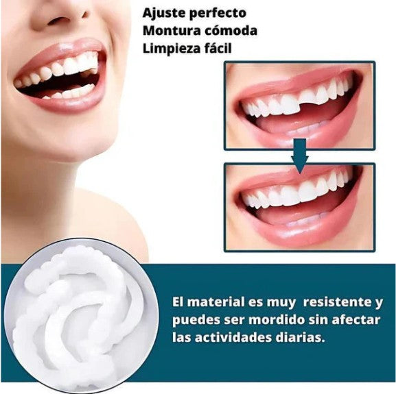 CARILLAS DENTALES 2X1 Snap-On Smile ENVIO GRATIS
