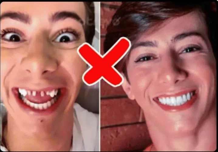 CARILLAS DENTALES 2X1 Snap-On Smile ENVIO GRATIS