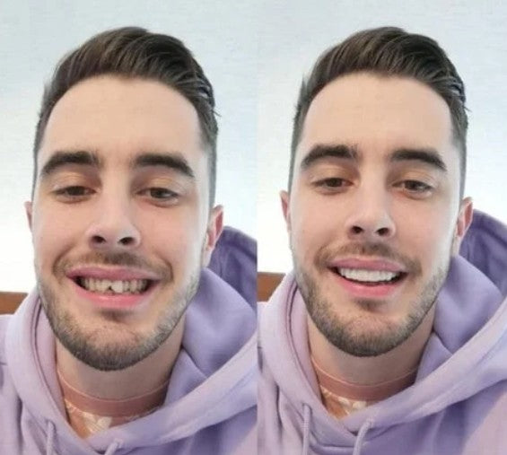 CARILLAS DENTALES 2X1 Snap-On Smile ENVIO GRATIS