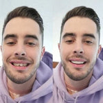 CARILLAS DENTALES 2X1 Snap-On Smile ENVIO GRATIS