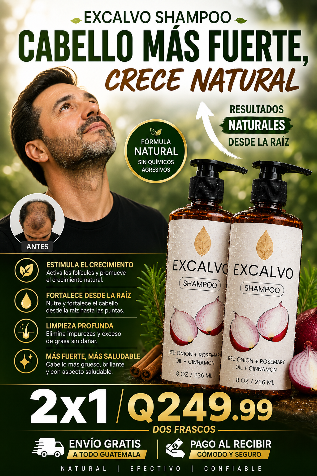 EXCALVO™ | Shampoo de Cebolla para Crecimiento y Reparación Capilar ⭐ (Recomendada)+ envio gratis