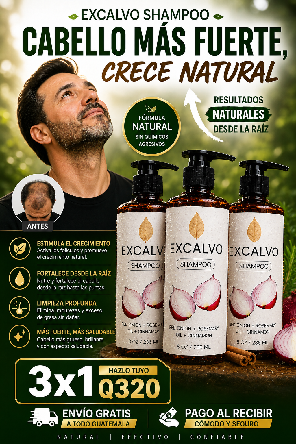 EXCALVO™ | Shampoo de Cebolla para Crecimiento y Reparación Capilar ⭐ (Recomendada)+ envio gratis