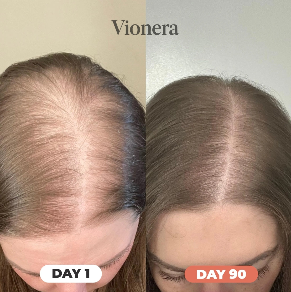 🎃 Pumpkin Seed Oil™ Gel Omega-3 | Apoya tu Salud Prostática y fortalece tu cabello desde hoy + Envio Gratis 🚚