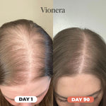 🎃 Pumpkin Seed Oil™ Gel Omega-3 | Apoya tu Salud Prostática y fortalece tu cabello desde hoy + Envio Gratis 🚚