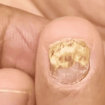 🌱JoyPretty™ el cuidado intensivo de uñas- Q160+ envio gratis  (manos y pies)