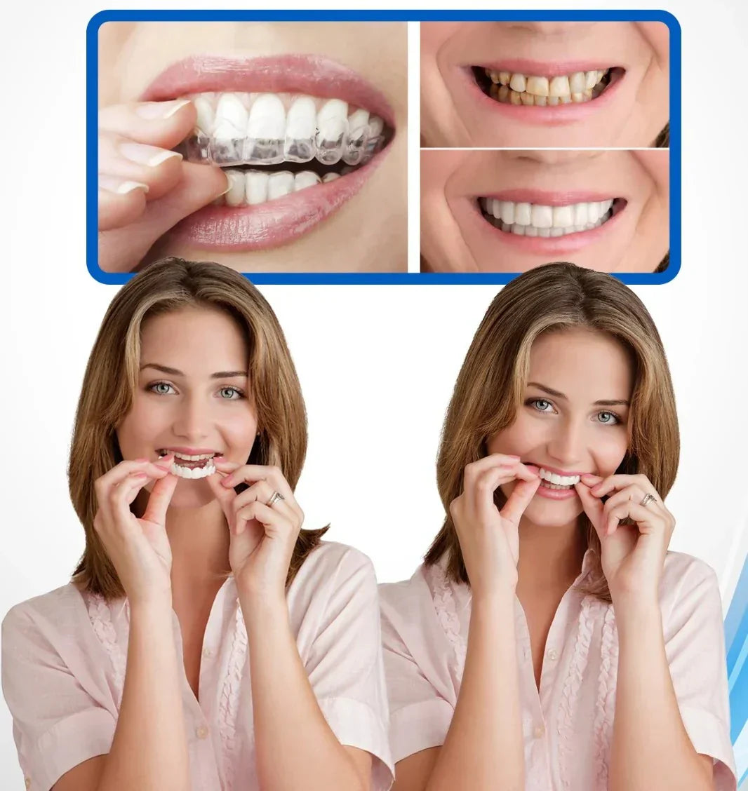 CARILLAS DENTALES 2X1 Snap-On Smile ENVIO GRATIS
